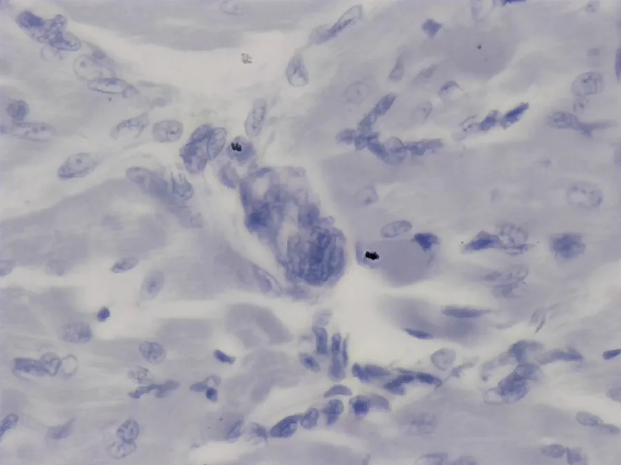 Muscle squelettique de chien, objectif 40x, *EDF*