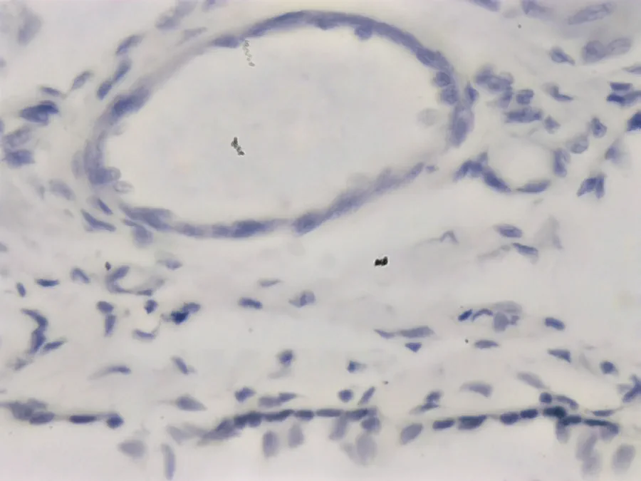 Muscle squelettique de chien, objectif 40x, *EDF*