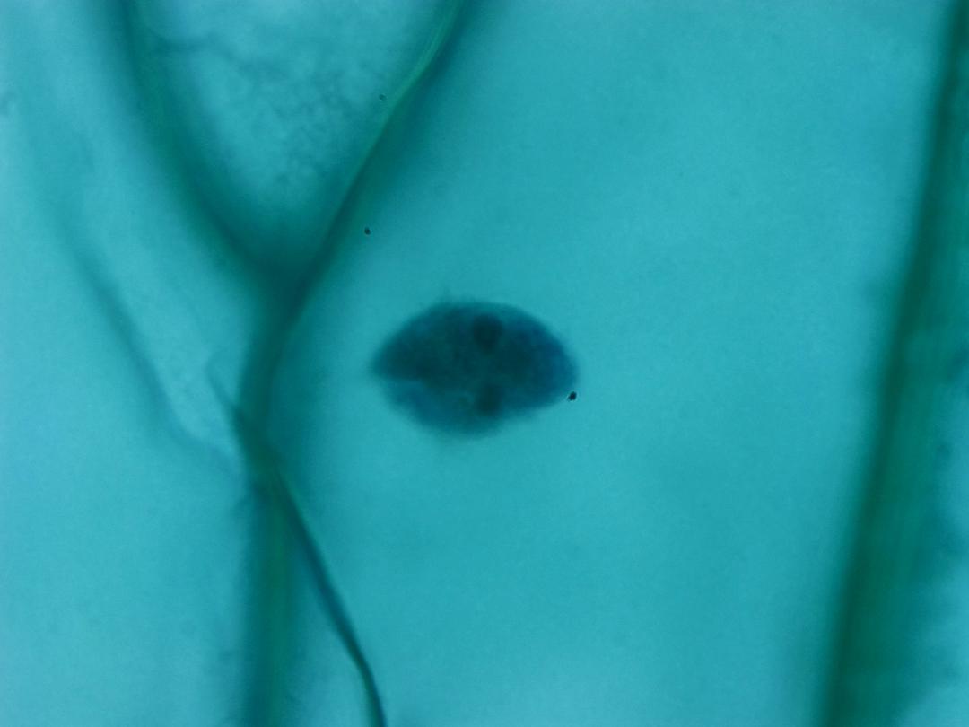 Épithélium d'oignon, objectif 40x