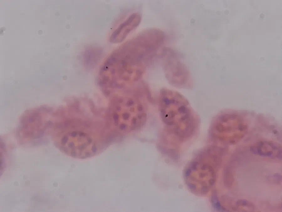 Testicule de lapin, objectif 100x