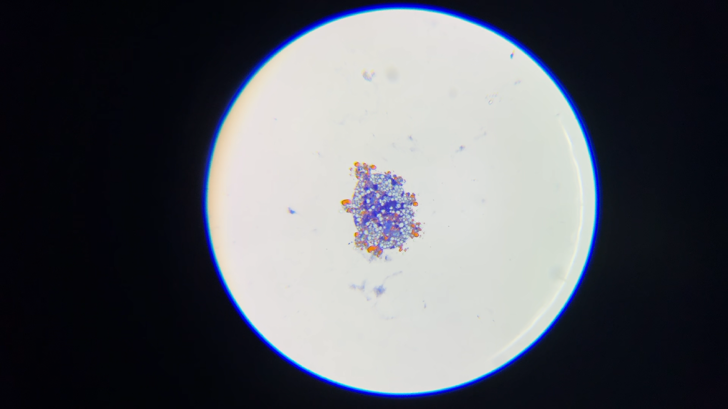 Coloration au bleu de méthylène