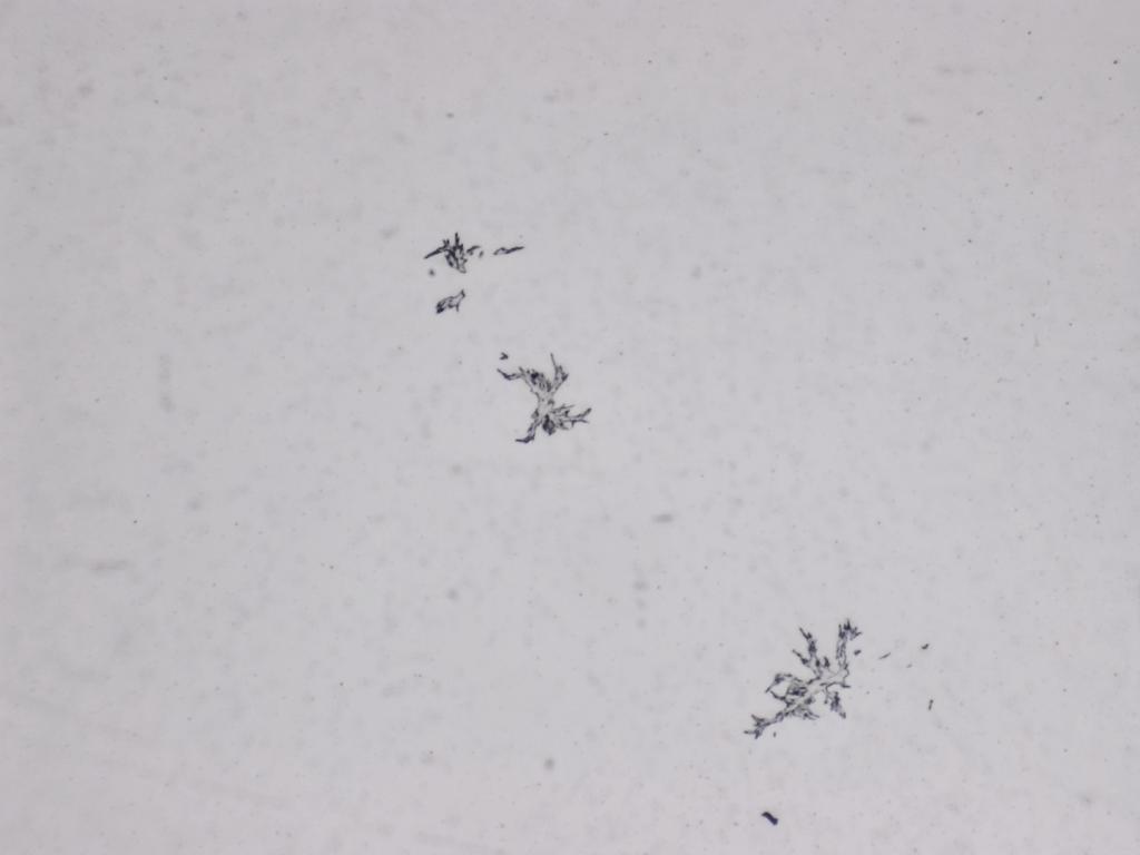 Structures microscopiques rappelant des estampes Structures microscopiques rappelant des estampes