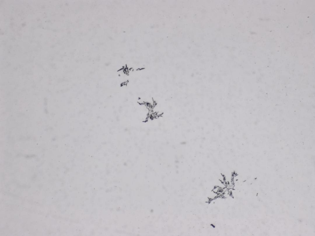 Structures microscopiques rappelant des estampes Structures microscopiques rappelant des estampes