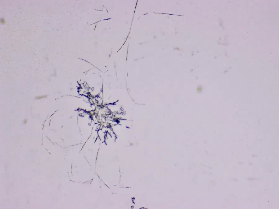 Structures microscopiques rappelant des estampes
