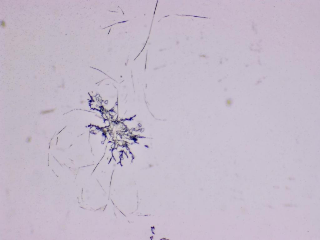 Structures microscopiques rappelant des estampes Structures microscopiques rappelant des estampes
