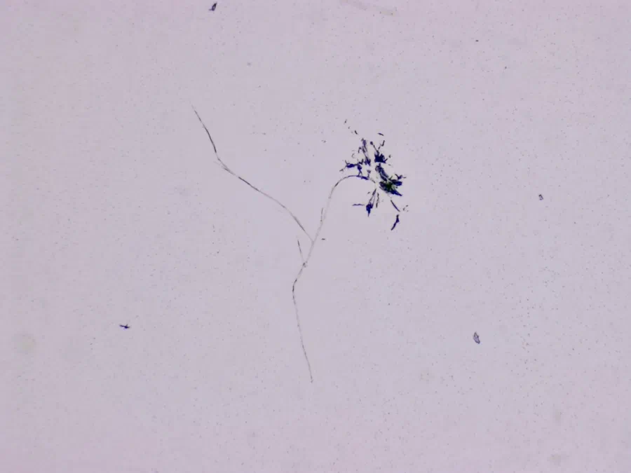 Structures microscopiques rappelant des estampes