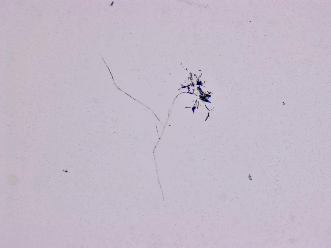 Structures microscopiques rappelant des estampes Structures microscopiques rappelant des estampes