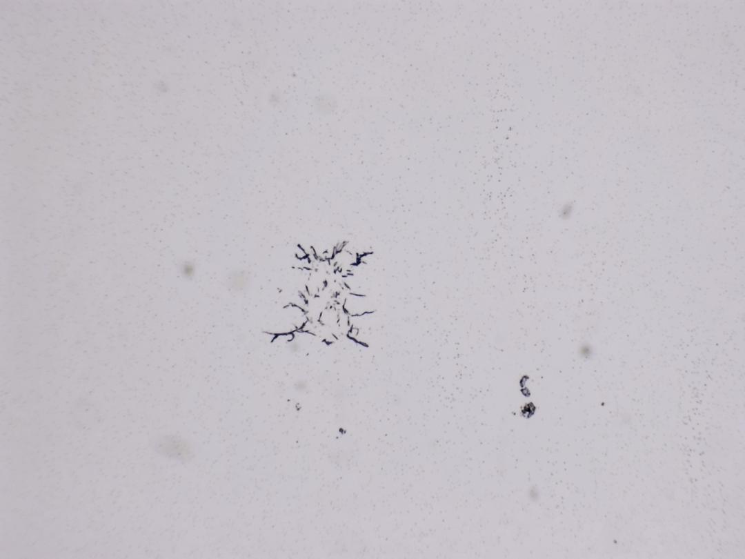 Structures microscopiques rappelant des estampes Structures microscopiques rappelant des estampes