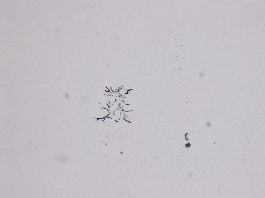 Structures microscopiques rappelant des estampes