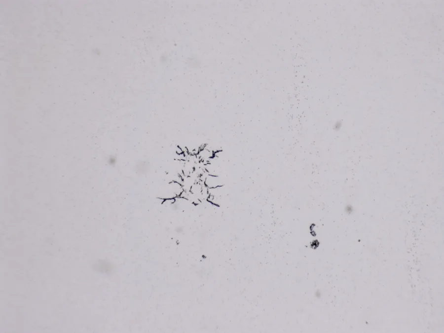 Structures microscopiques rappelant des estampes