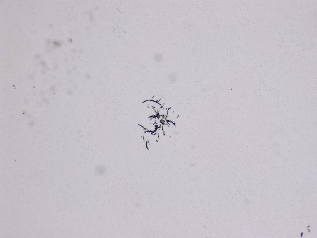 Structures microscopiques rappelant des estampes Structures microscopiques rappelant des estampes