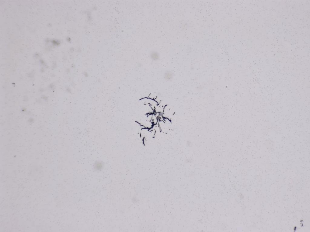 Structures microscopiques rappelant des estampes Structures microscopiques rappelant des estampes