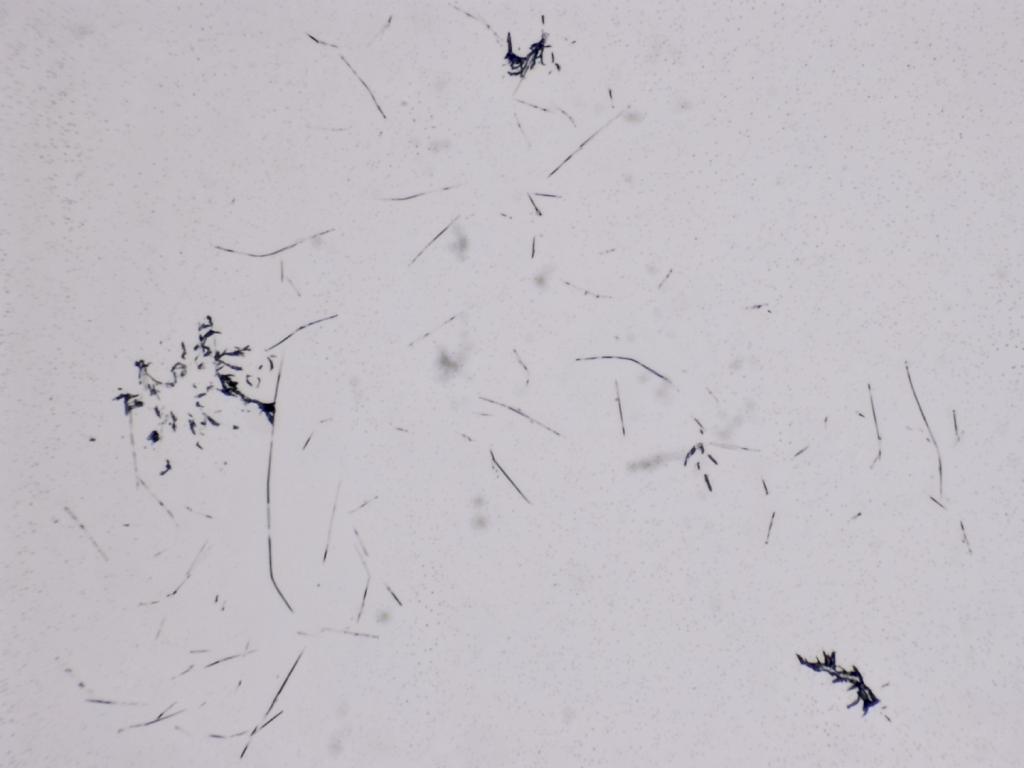 Structures microscopiques rappelant des estampes Structures microscopiques rappelant des estampes