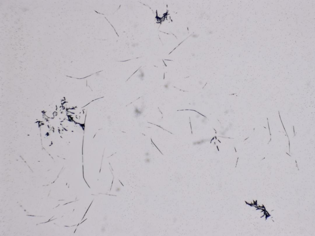 Structures microscopiques rappelant des estampes Structures microscopiques rappelant des estampes