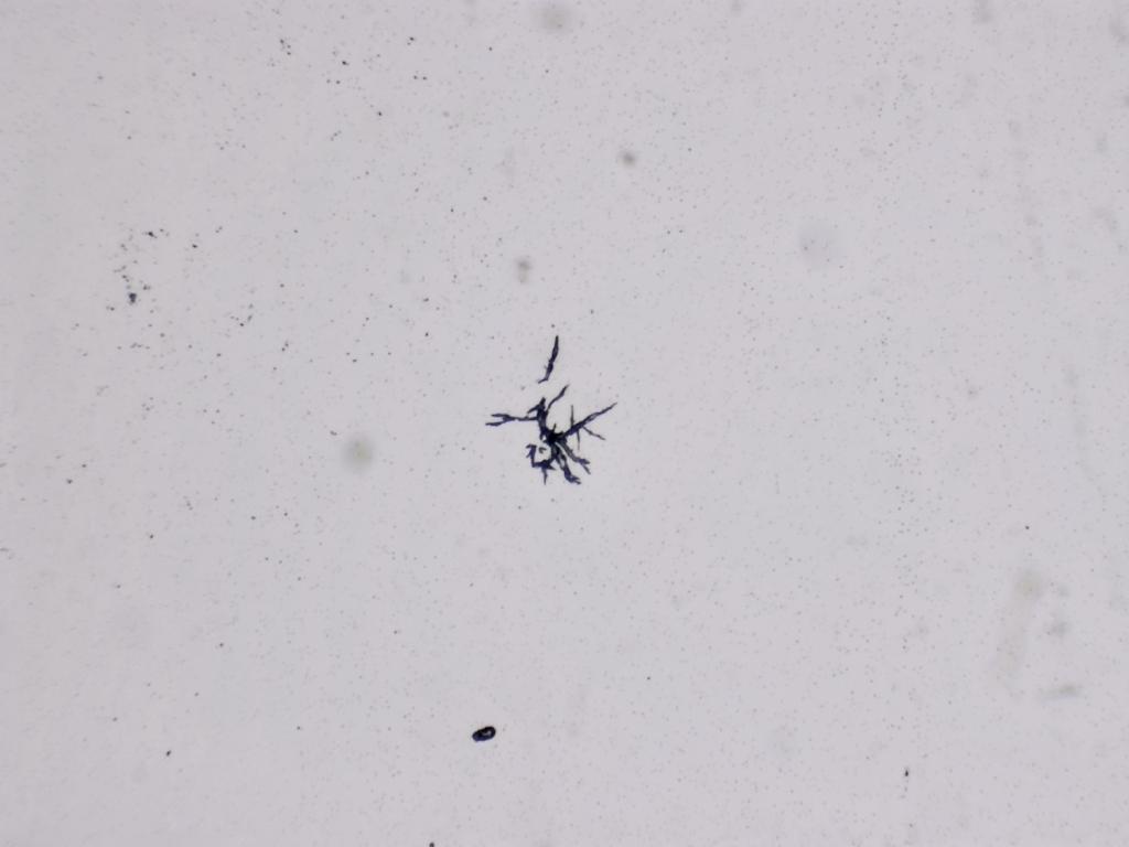 Structures microscopiques rappelant des estampes Structures microscopiques rappelant des estampes
