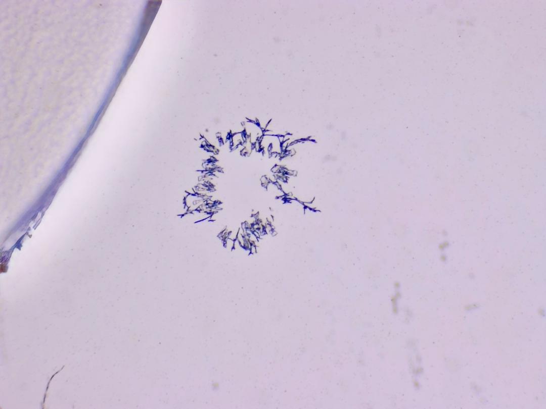 Structures microscopiques rappelant des estampes Structures microscopiques rappelant des estampes