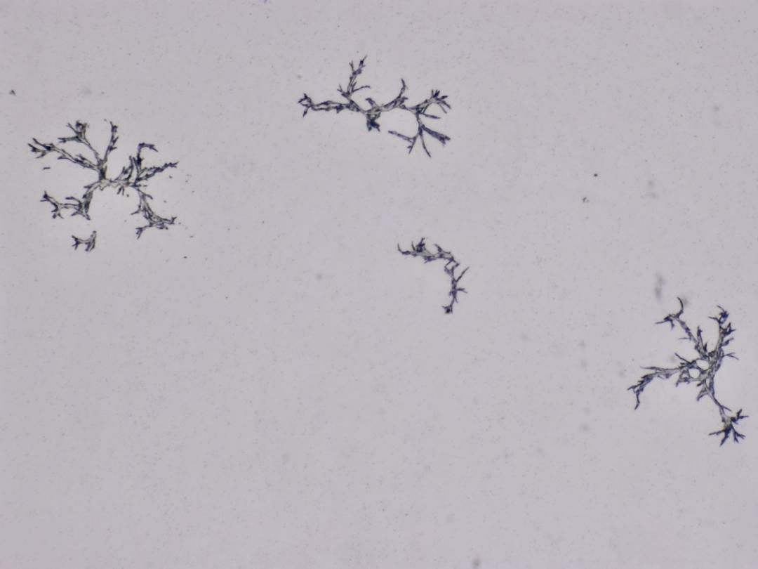 Structures microscopiques rappelant des estampes Structures microscopiques rappelant des estampes