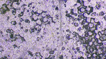 Image de couverture pour Grassette commune