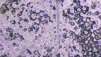 Image de couverture pour Grassette commune